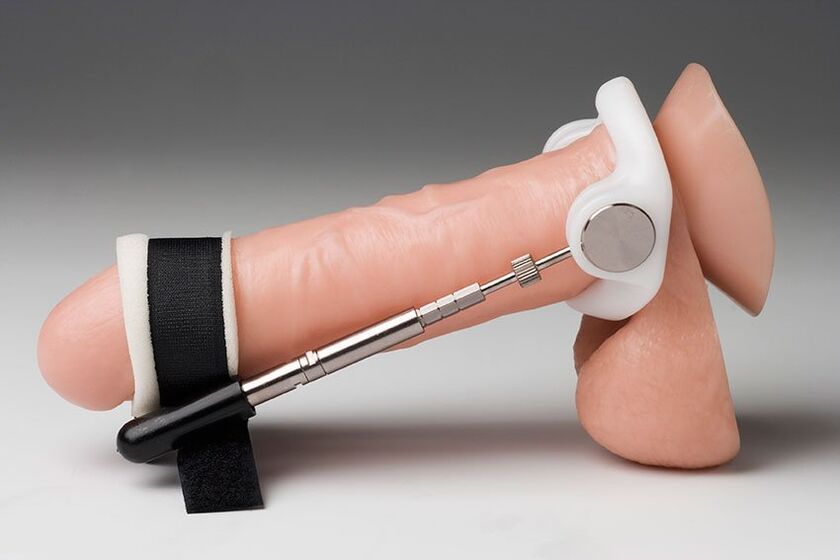Na maioría das veces, úsanse un extensor e bombas de baleiro para ampliar a cabeza.